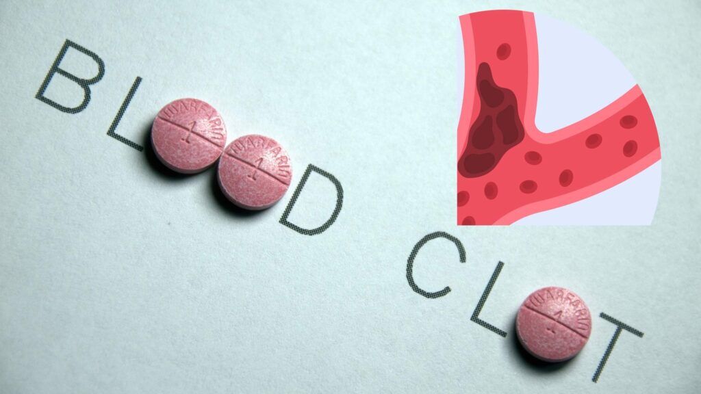 Can Semaglutide Cause Blood Clots