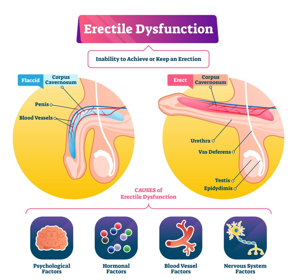  erectile dysfunction causes