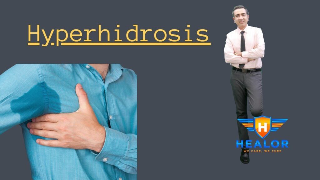 Best Hyperhidrosis Diagnosis and Treatments 1 Hyperhidrosis