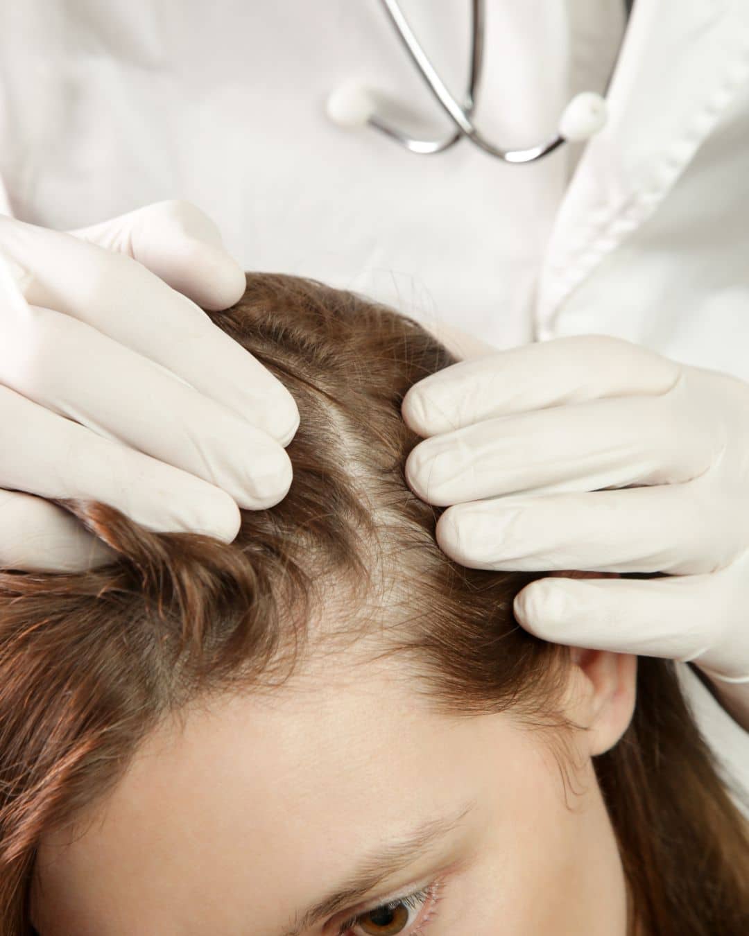 Comparing Medical and Non-Medical Hair Loss Solutions