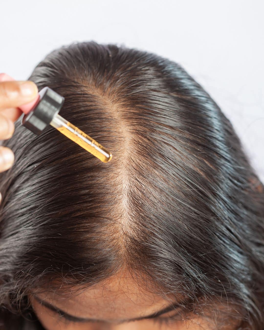 FDA-Approved Medications That Stimulate Hair Regrowth