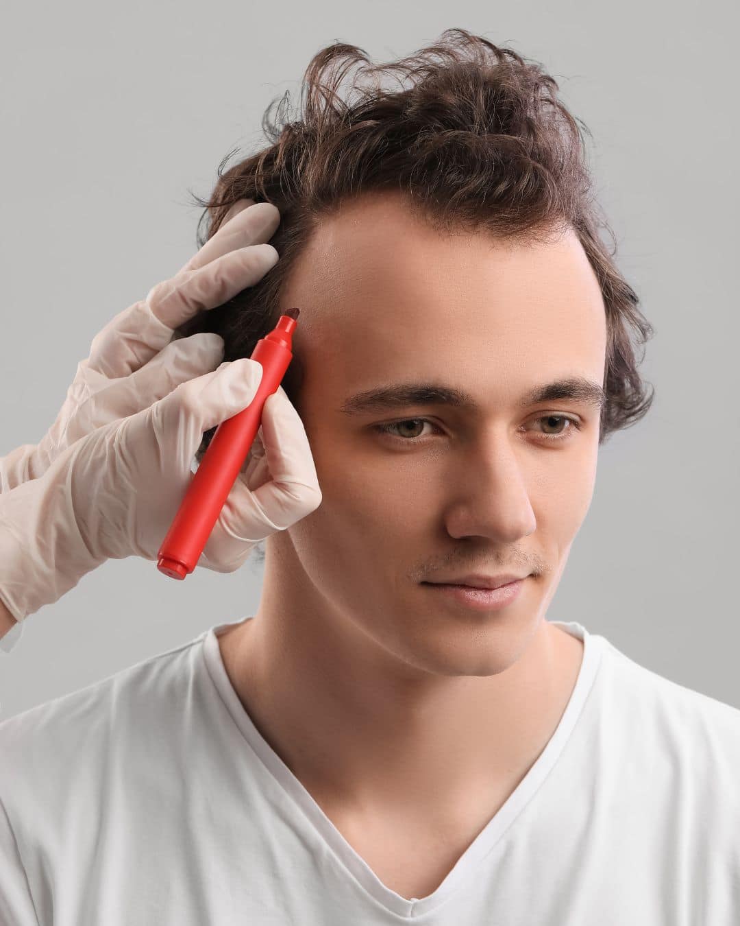 Identifying Your Hair Loss Pattern and Root Causes