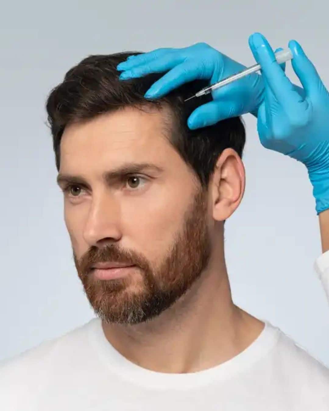 PRP Therapy for Hair Restoration and Density