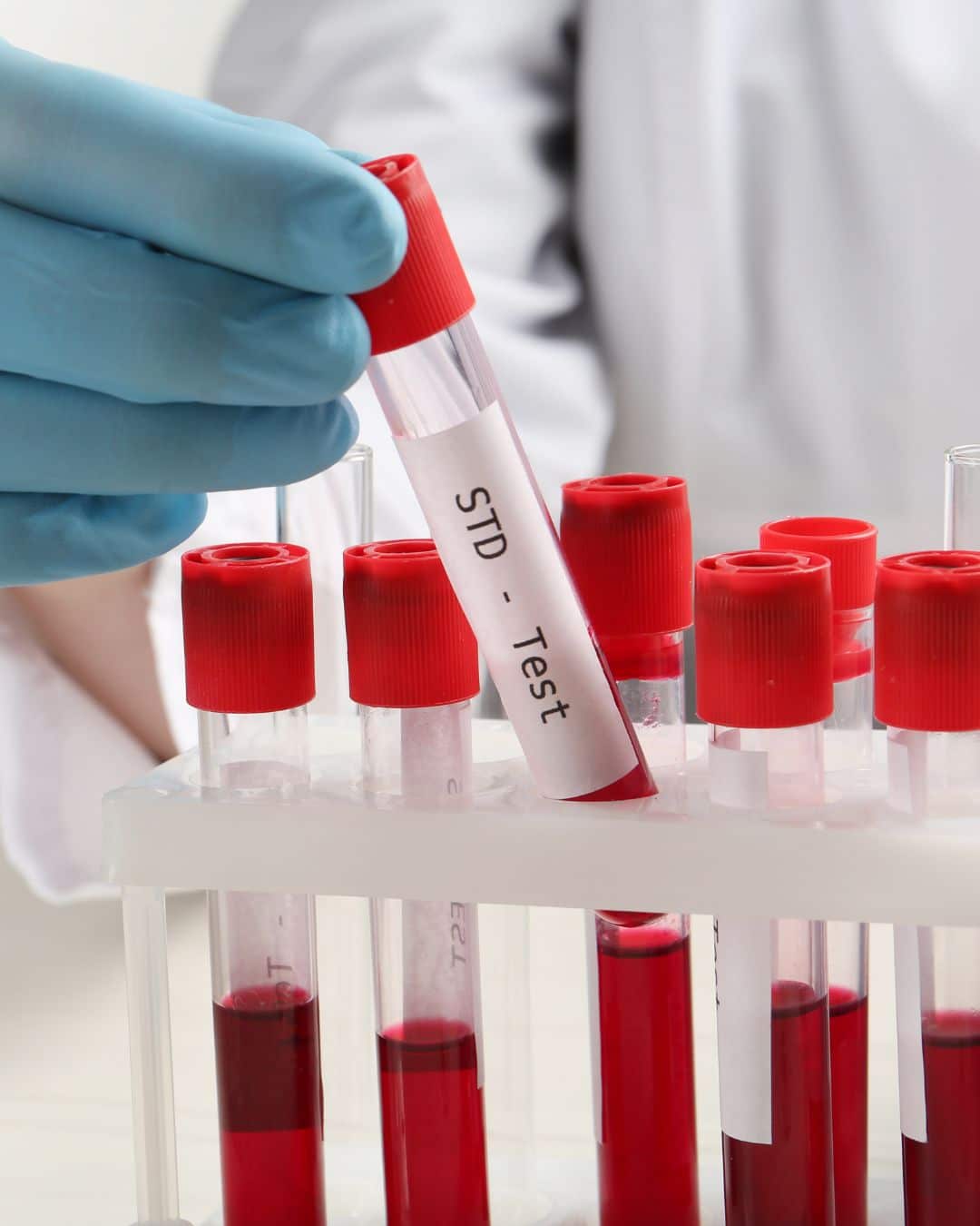 STD Testing