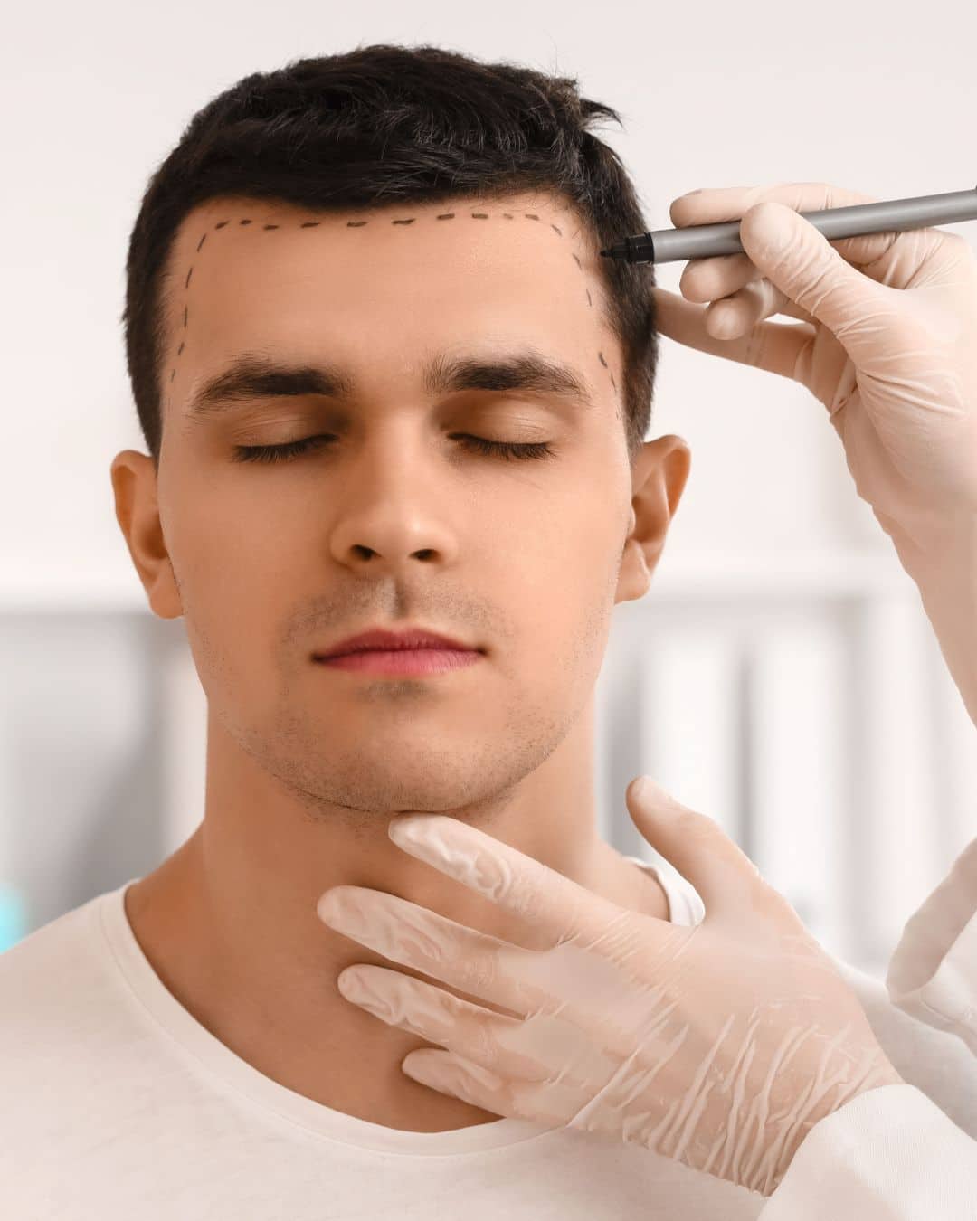 What hair loss treatments work best in Las Vegas
