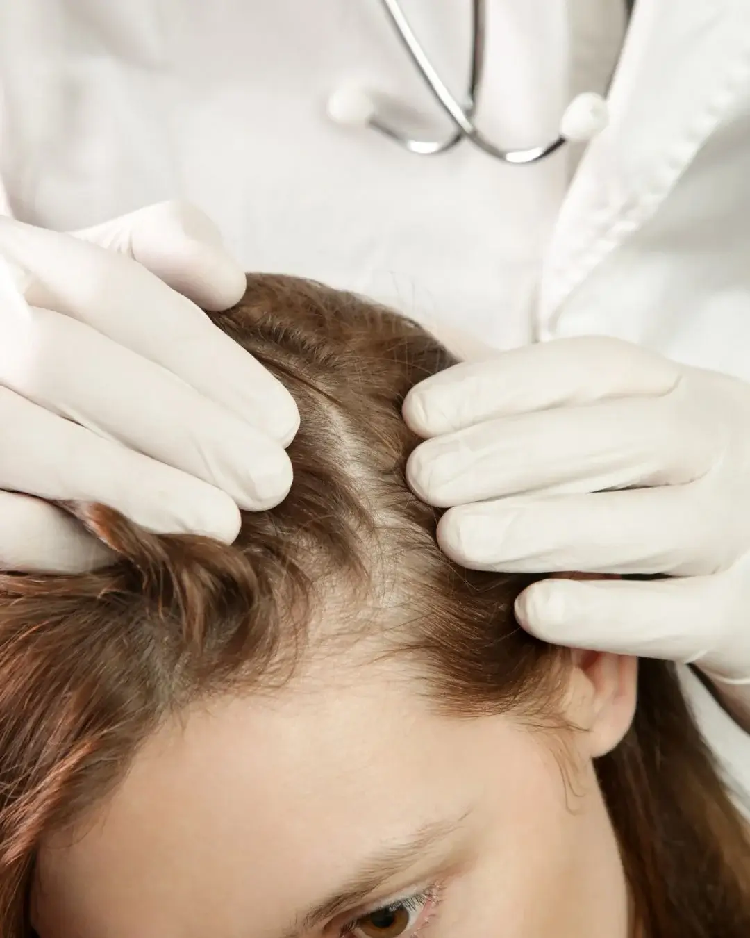 Dealing With Pain or Hair Loss in Las Vegas