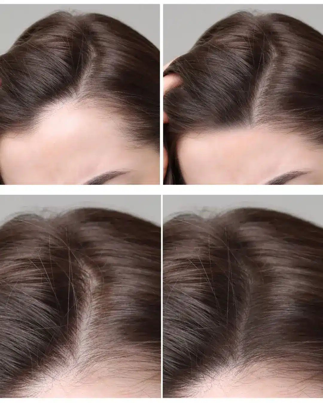 How PRP Therapy Works in Las Vegas